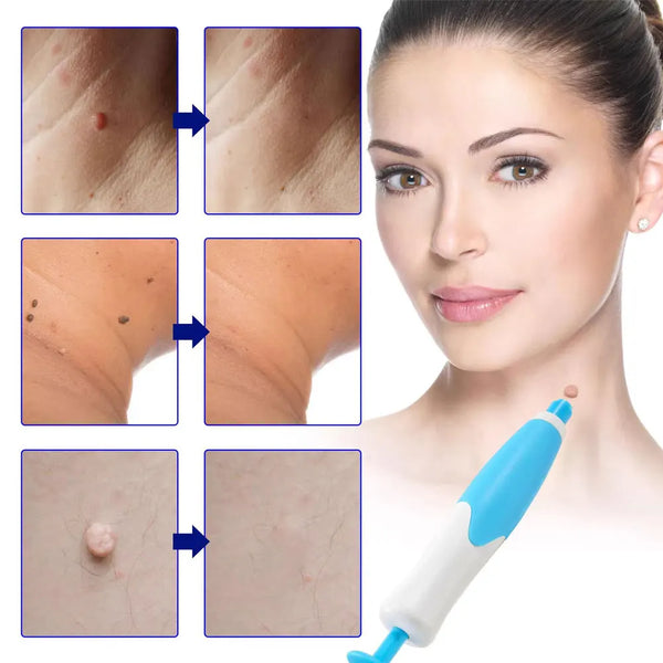 EasySkin Tag Remover