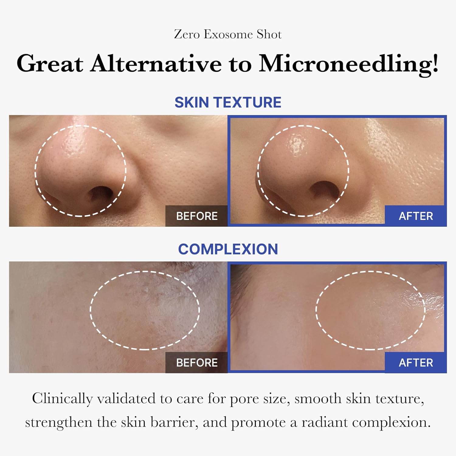 Zero Pore Power Trio