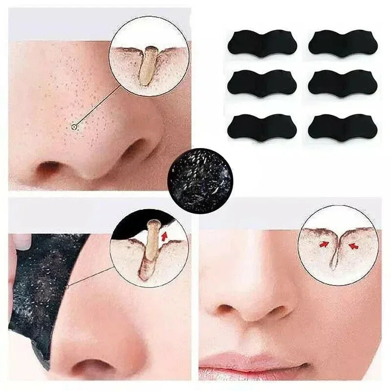 ClearPore Nose Strips