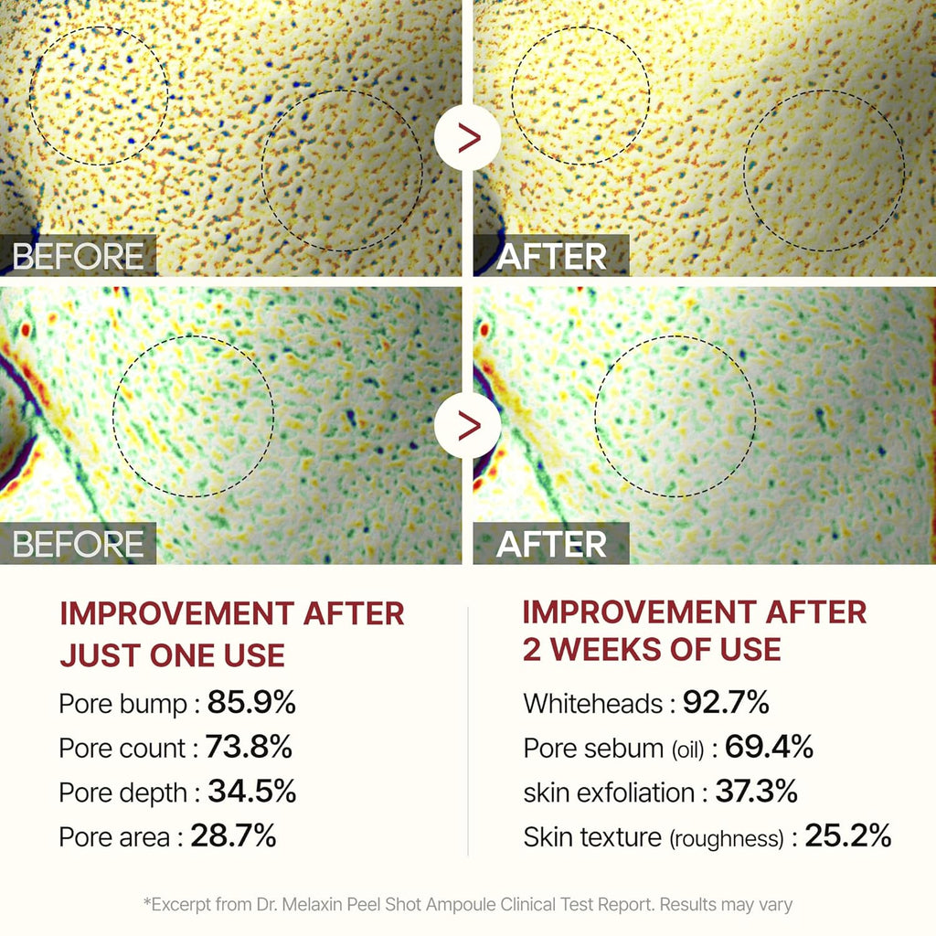 RiceGlow Dual Peel Duo